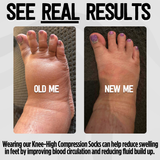 Bamboo Fruit Salad Compression Socks