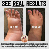 Grip Ankle Compression Socks 10 Pack Mixed